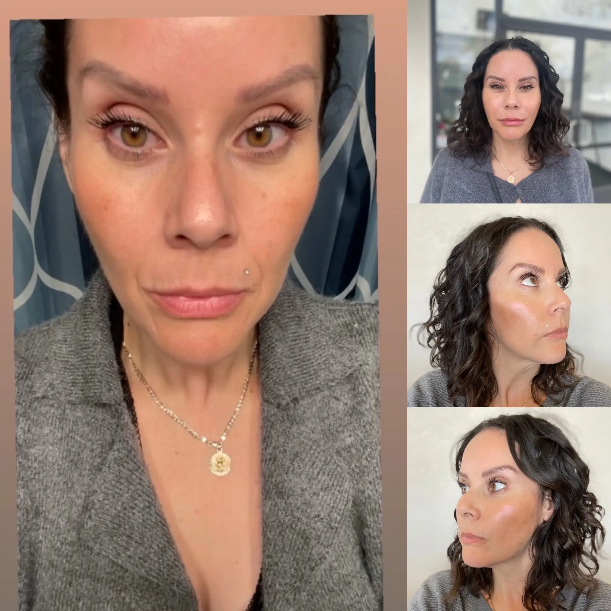 Before After r | Pink Opal Aesthetics | San Mateo, CA