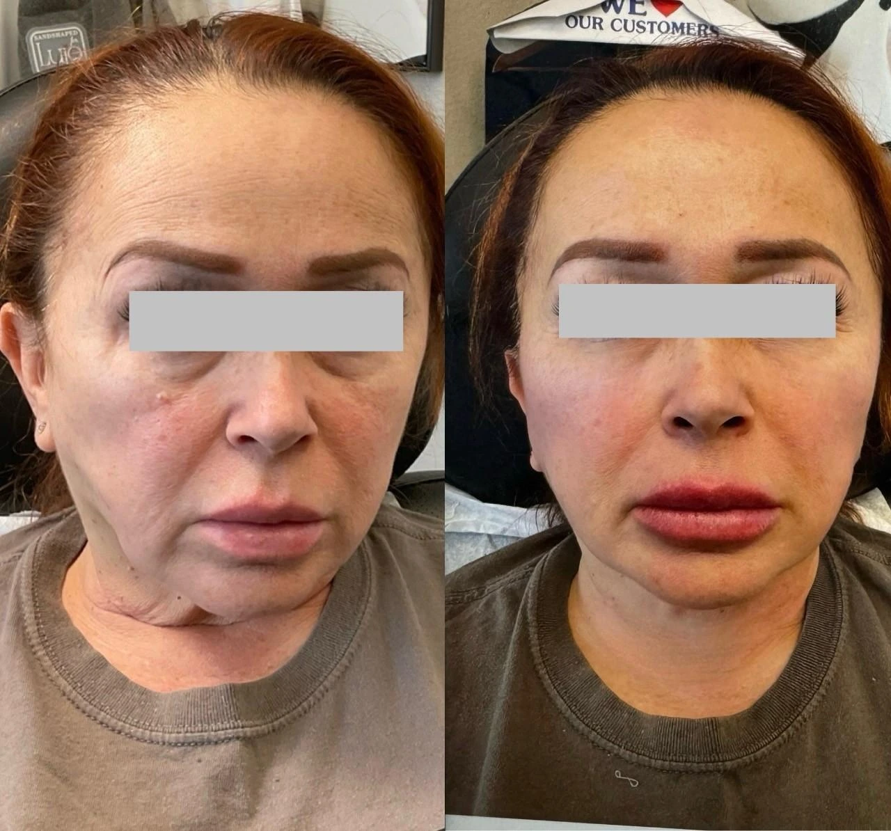 Gallery Facial Balancing | Pink Opal Aesthetics | San Mateo, CA