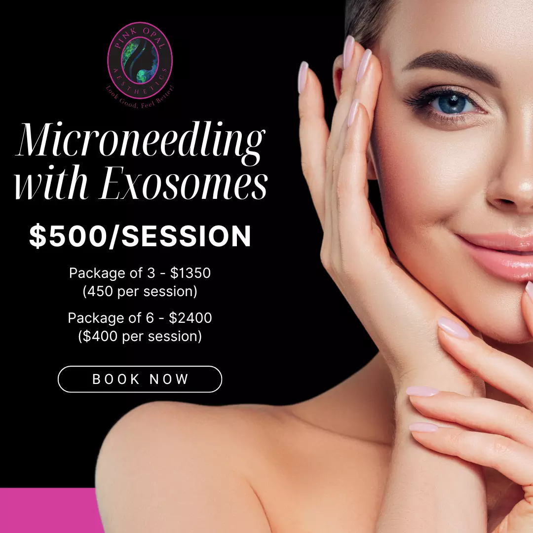 Microneedling with Exosomes Session | Pink Opal Aesthetics