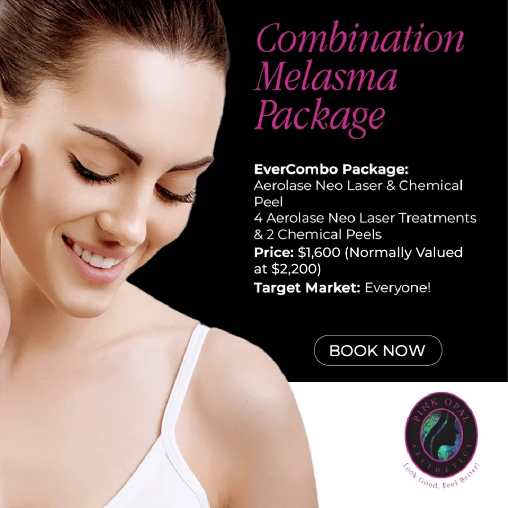 Combination Melasma Package in San Mateo, CA