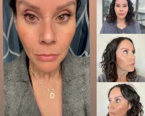 Before After r | Pink Opal Aesthetics | San Mateo, CA